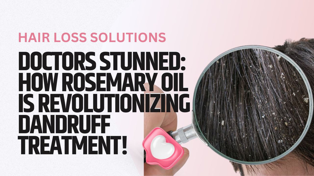 Rosemary Oil for Dandruff