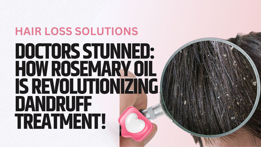 Rosemary Oil for Dandruff