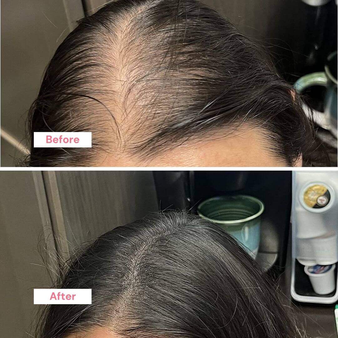 ProActive Hair Booster Oil Trio Kit | Menopause Hair Loss