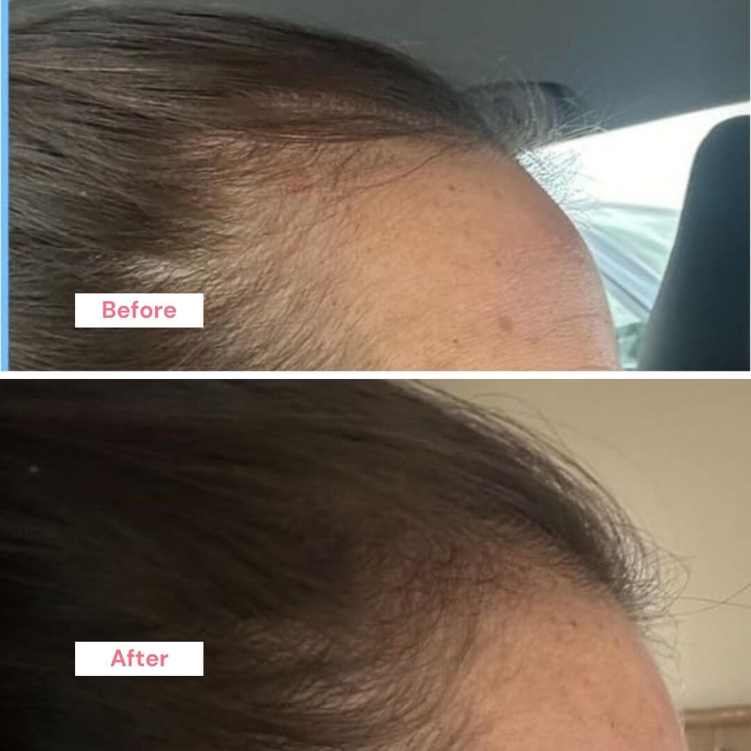 ProActive Hair Booster Oil Trio Kit | Menopause Hair Loss