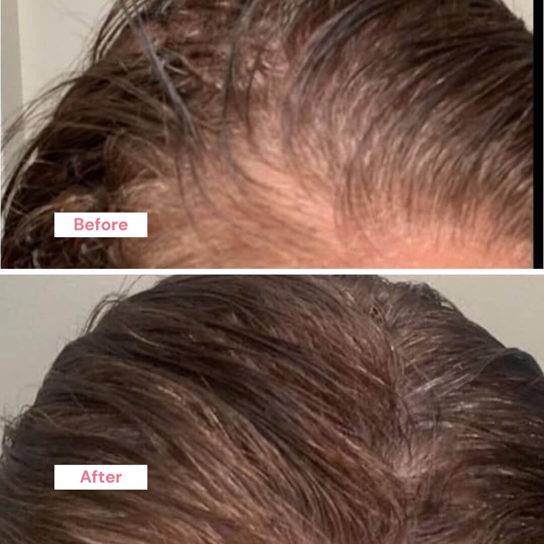 ProActive Hair Booster Oil Trio Kit | Menopause Hair Loss
