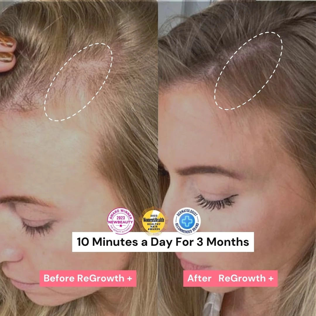 ReGrowth+ Hair Stimulating Brush