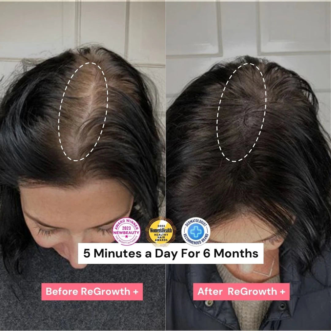 ReGrowth+ Hair Stimulating Brush