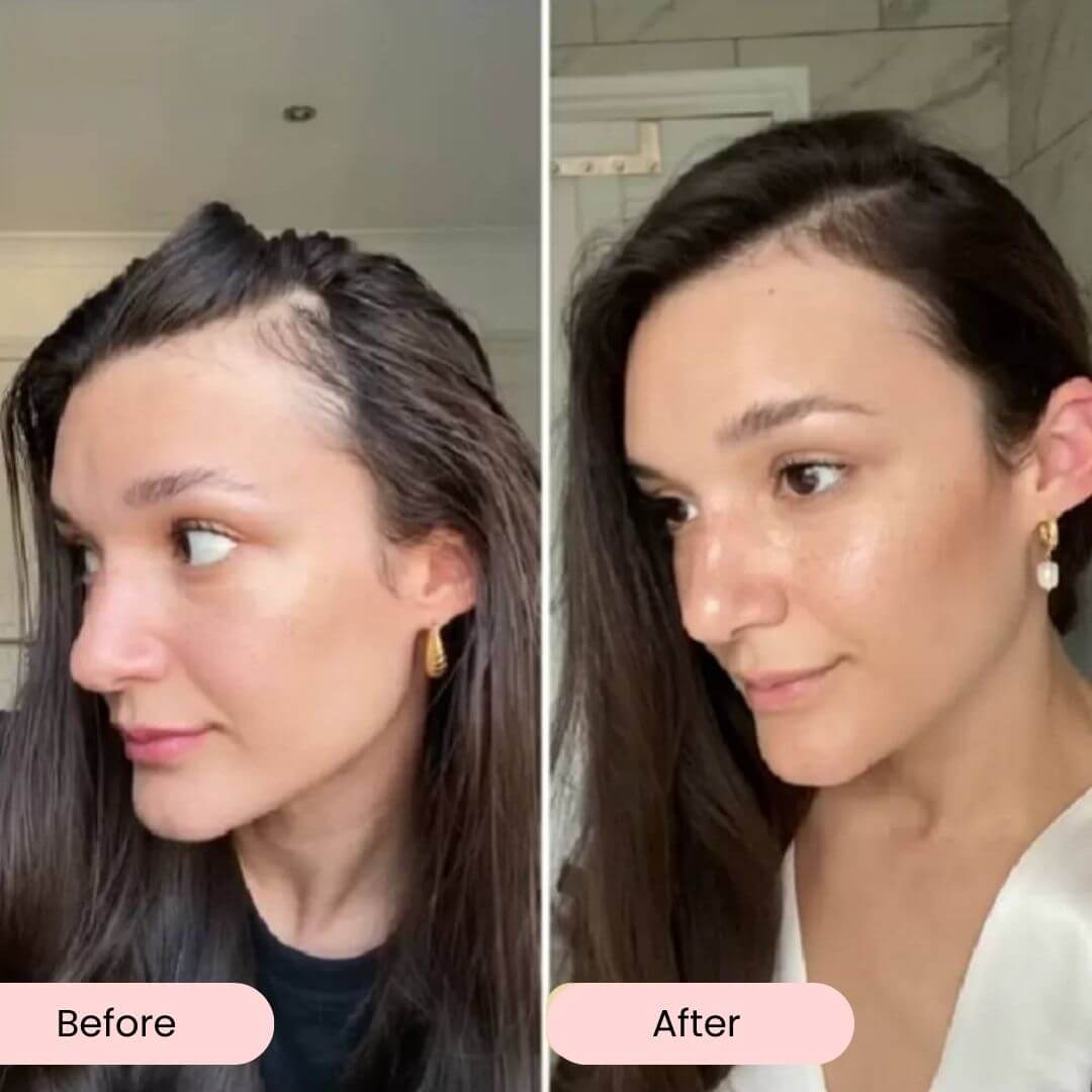 ProActive Rosemary Hair Booster Oil | Hair Strengthening