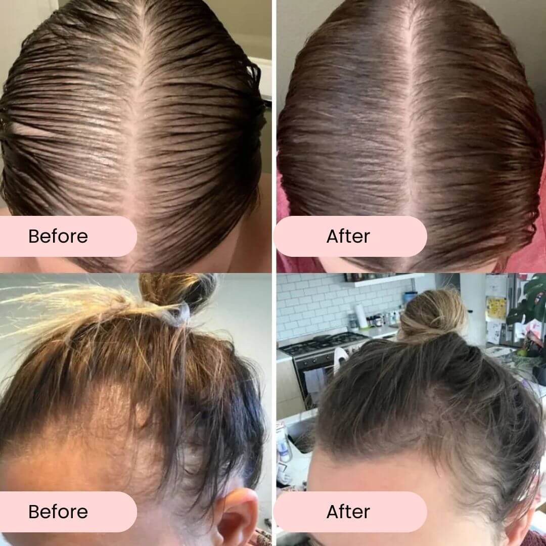 ProActive Hair Booster Oil Trio Kit | Menopause Hair Loss