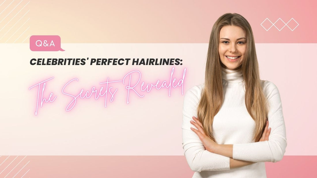 Celebrities' Perfect Hairlines